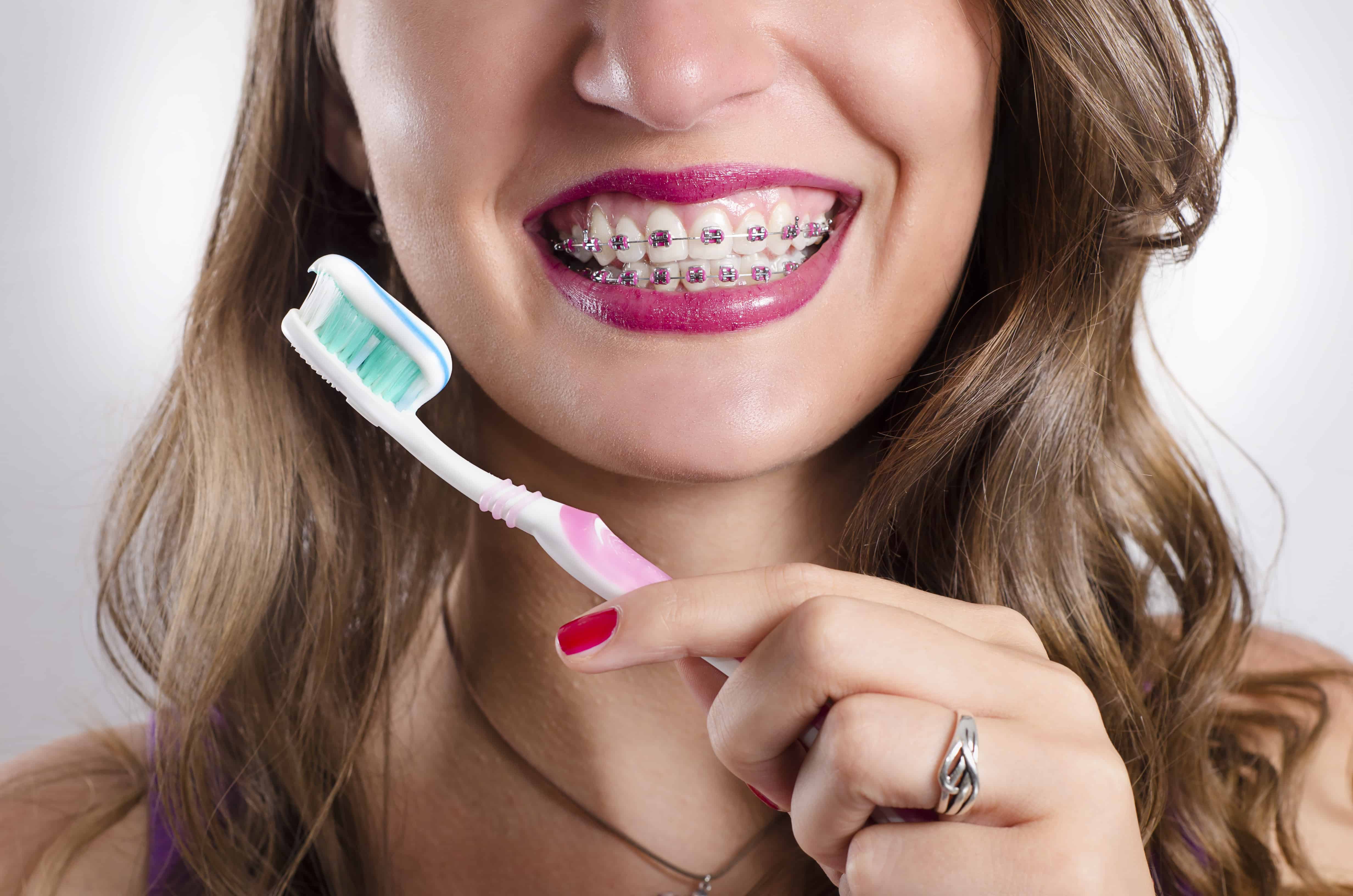 whitening toothpaste with braces